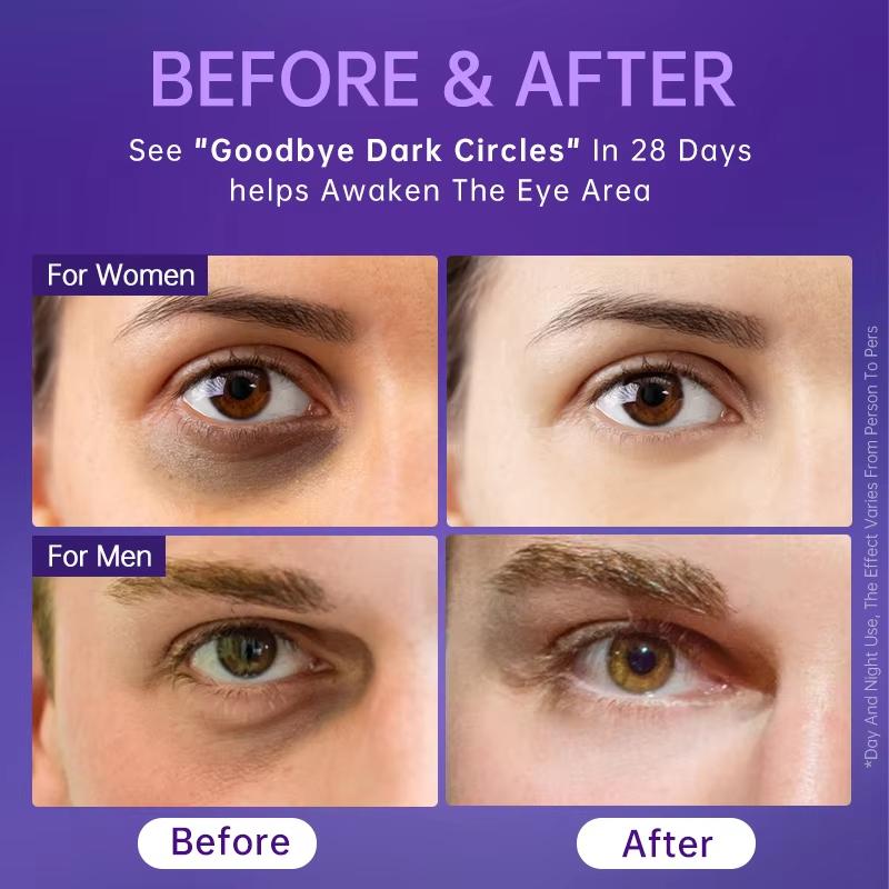 AUQUEST Ultra Light Whitening Eye Cream Reduces Dark Circles Removes Dark Spots Evens Out Skin Tone Reduces Fine Lines 20 Grams