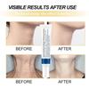 Face Lift Firming Whitening Smoothing Care Lotion Hydrolyzed Collagen Neck Cream Moisturizing Neck Rejuvenation Cream