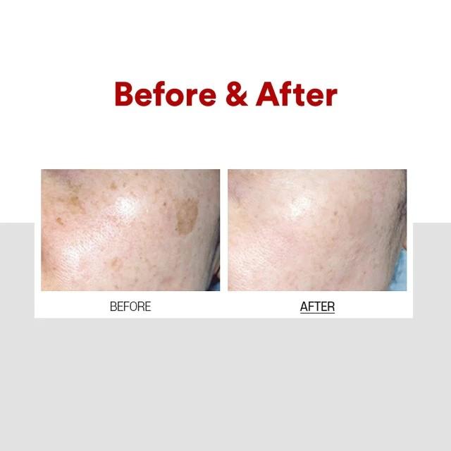 MEDI-PEEL Melanon X Crema 30ml