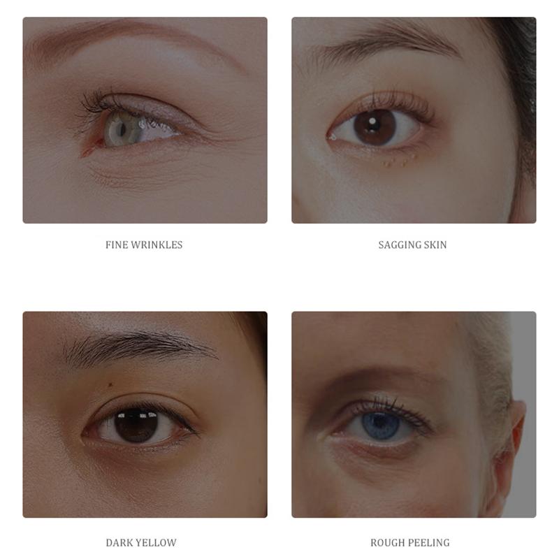 SENANA Caviar Eye Cream Moisturizing Diminishing Dark Circles and Bags Under The Eyes Lifting and Tightening Small Brown Bottle Eye Cream