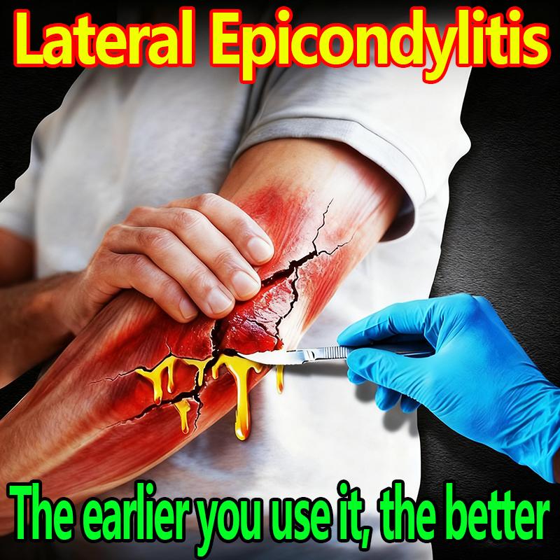 Elbow Pain Relief Patch for Tennis Elbow, External Humeral Epicondylitis