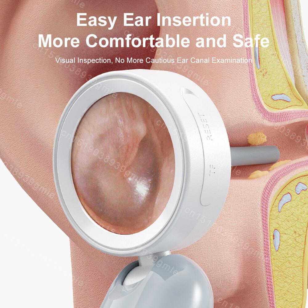 Ear Nose Visual Smart Endoscope Hd Camera Scope 1080P 1.38'' Wireless Portable Otoscope Cleaner with 12 Eartips for Adult Child