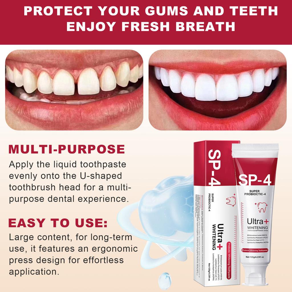 SP-4 Toothpaste, 120g Large Sp-4 Probiotic Toothpaste, SP-4 Whitening Toothpaste, Fresh, Breath, Toothpaste, Toothpaste, Stain Removal