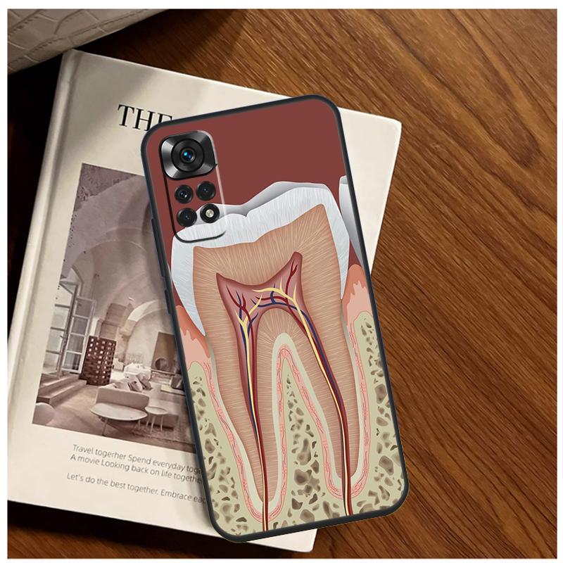 Human Tooth Anatomy Case For Xiaomi Redmi Note 13 11 10 9 8 12 Pro Plus 12S 11S 10S 9S 10A 9C 10C 12C 13C Funda