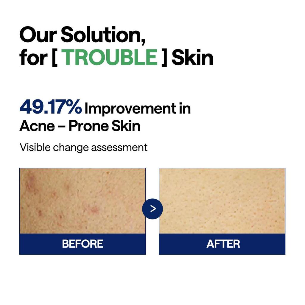 MEDIHEAL OFFICIAL Square Facial Toner Pads 100 Blemish Removal Korean Cosmetics (Tea Tree) Sheets, 170ml, Pads,