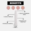 House of Beauty Magic Wand (High Frequency)