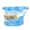 Dental Orthodontic Teeth Tooth Model 4 Kinds Brackets Ceramic and Metal Brackets for Patient Communication Dental Study Model