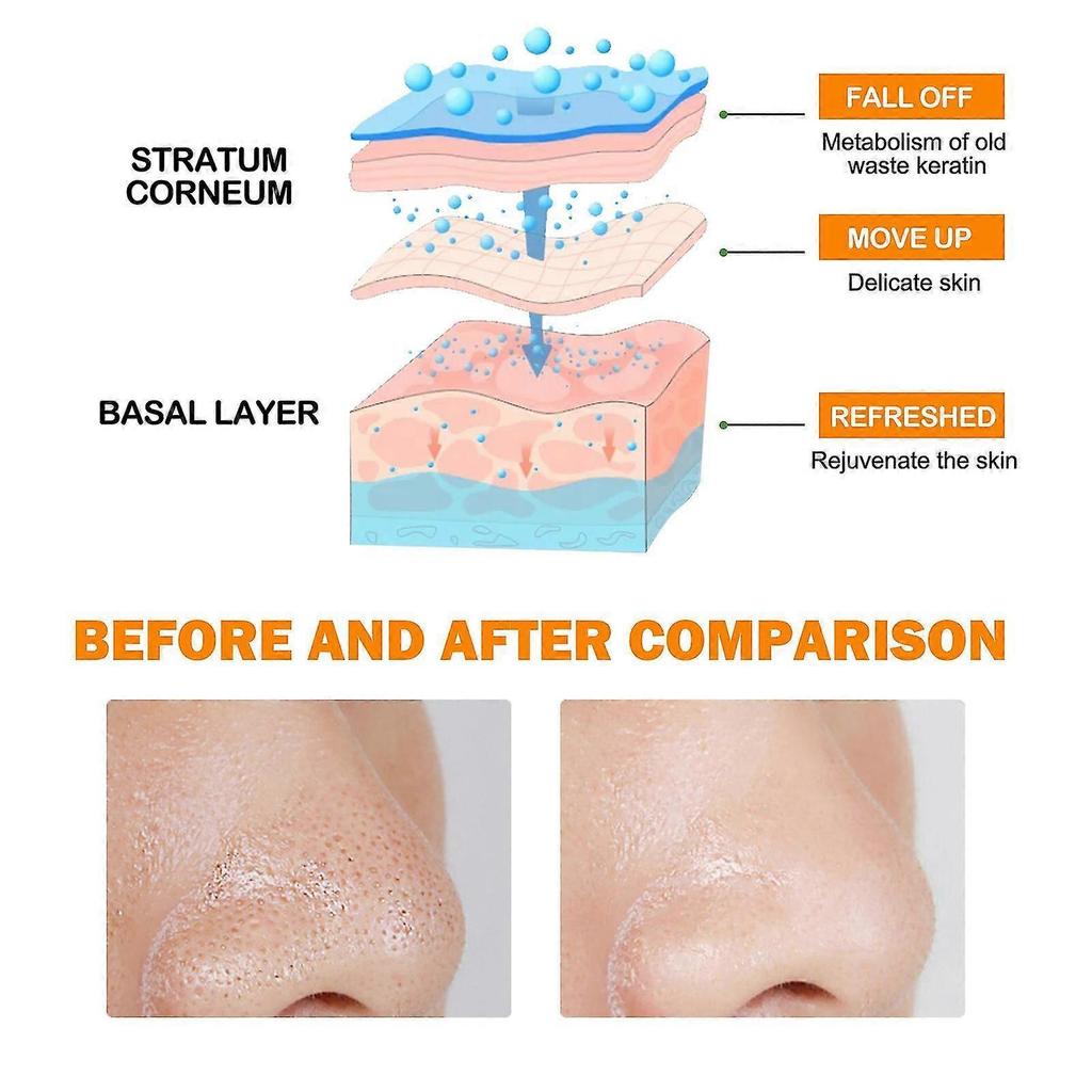 Orange Enzymes Exfoliating Brightening Gel, Remove Blackheads Deep Cleansing, Orange Exfoliating Gel Scrub Face Body Skin Natural Peeling Gel