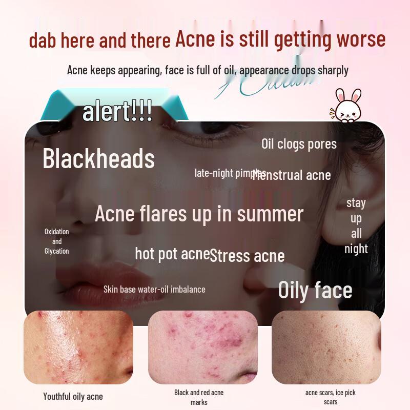 FIVERAMS Teen Acne Treatment Cream 30g