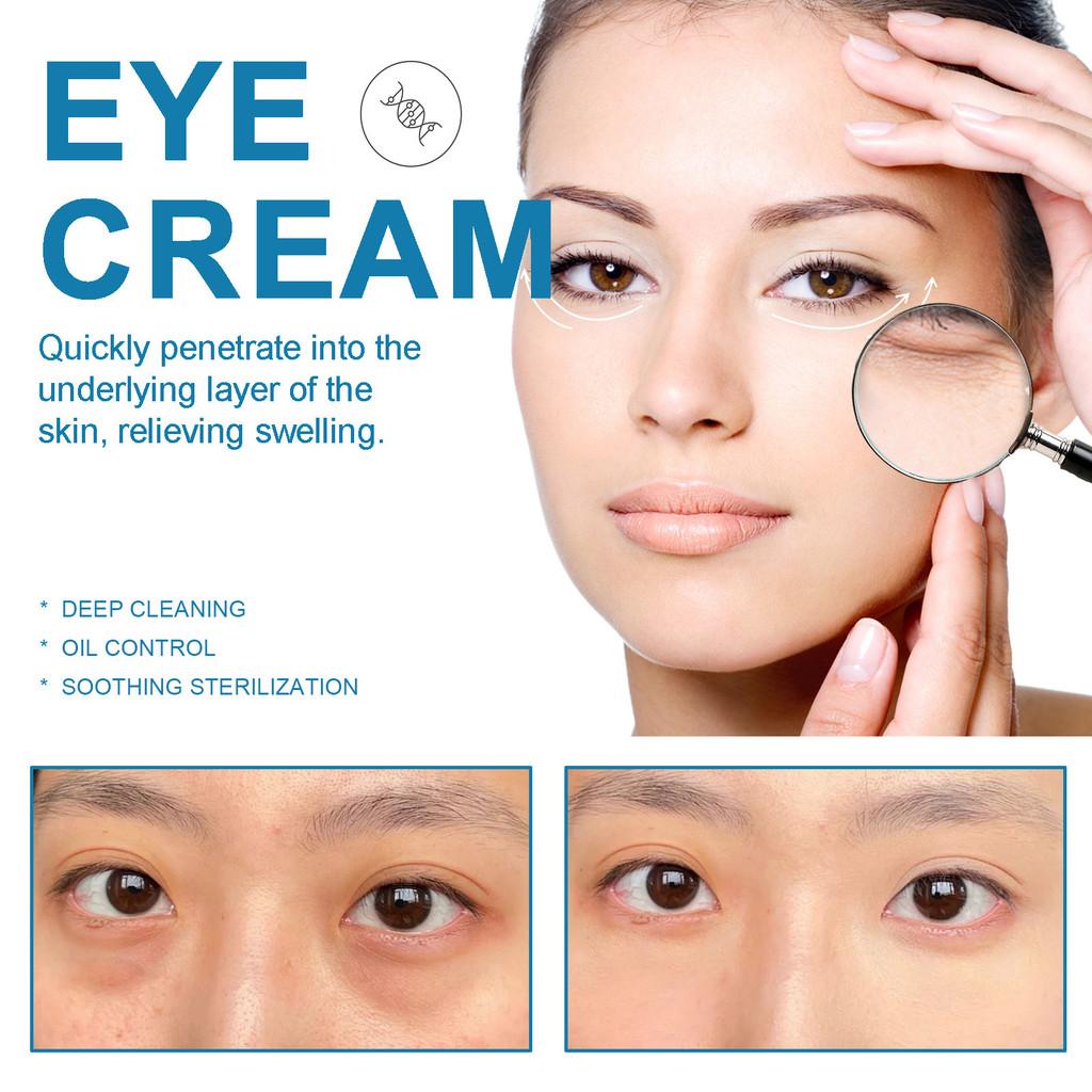 Wiyun Retinol Eye Cream For Dark Circles Puffiness Fine Lines Hydrating Smooth Skin