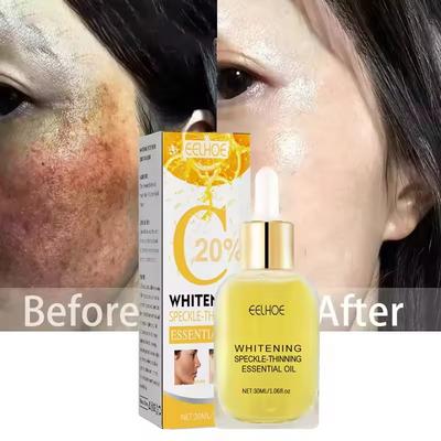 Bělící sérum na pihy Korekce melaninu Zesvětlení pigmentových skvrn Odstranění melasmy Hydratační sérum pro rozjasnění tmavých skvrn Péče o krásu pleti