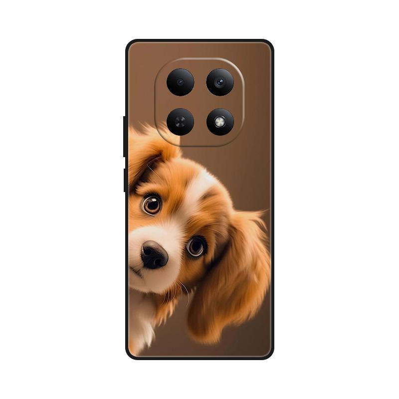 For Xiaomi Redmi Note 15 5G Case Silicone TPU Cover Redmi Note15 Case TPU Phone Protector For Redmi Note 15 4G Global Cover