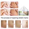 Stretch Mark Cream Pregnant Women Postpartum Stretch Marks  Crema Para Blanquear La Cara Skin Whitening Cream