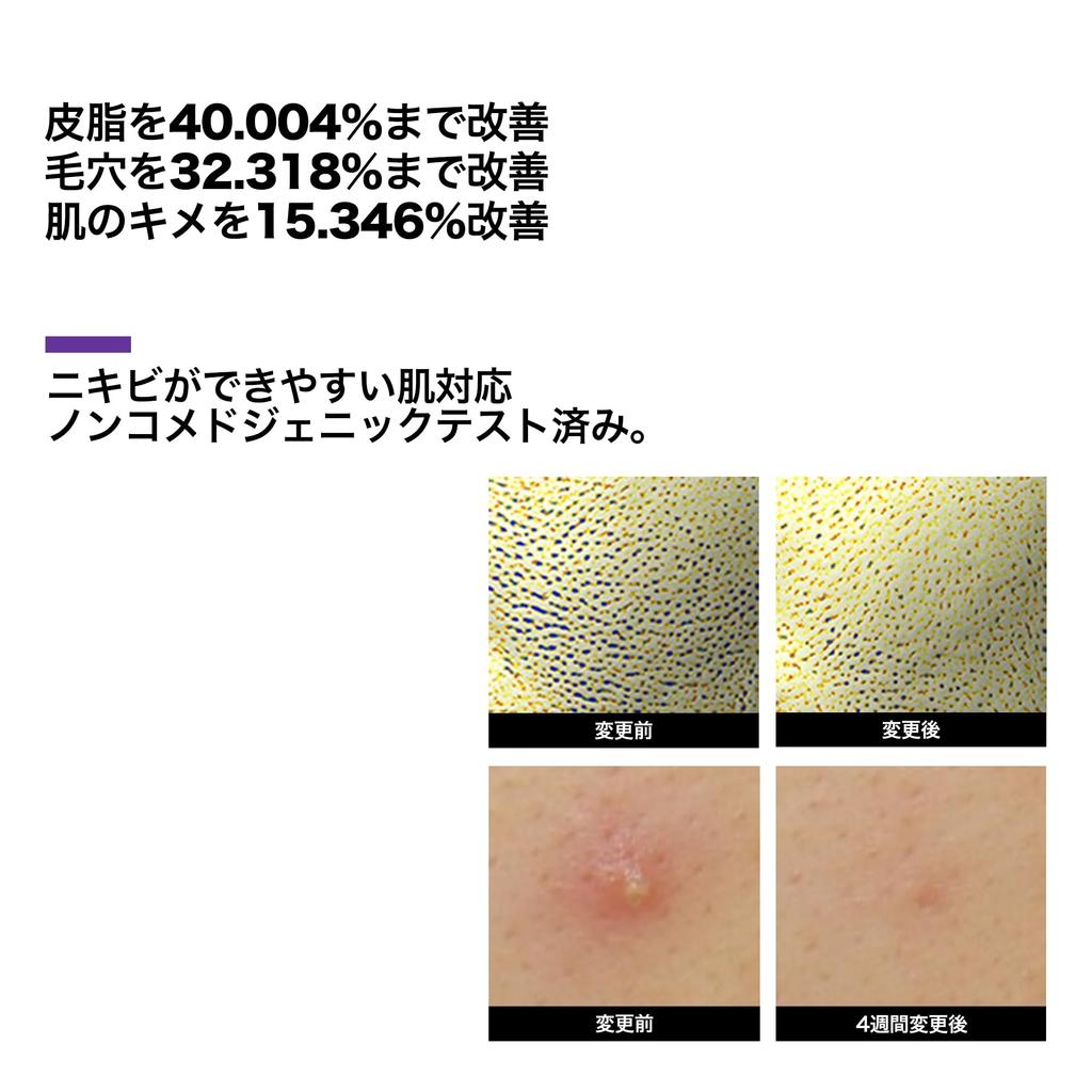 SOMEBYMI Retinol Intense Reactivating Serum 30ml RETINOL INTENSE REACTIVATING SERUM 30ml Pores Sensitive Skin Essence Moisturizing Moisturizing Serum