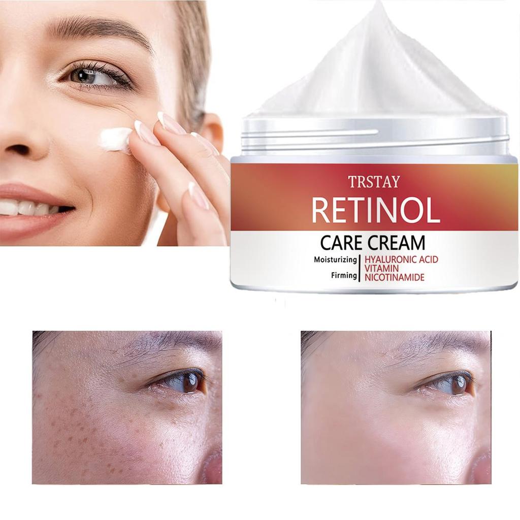 Whitening and moisturizing cream for freckle correction, reducing aging, anti-oxidation, nourishing , moisturizing and hydrating skincare cream