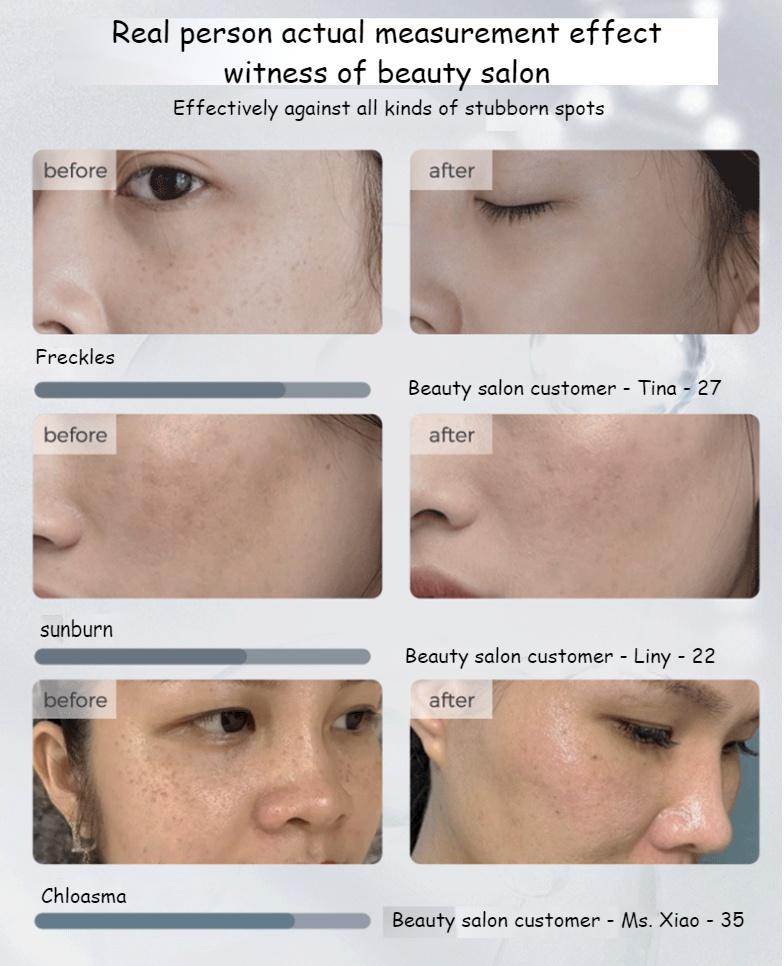 377 Whitening Cream VC Cream Freckles Chloasma Senile Plaques Beauty Salons Yellowing Cream Control Cream