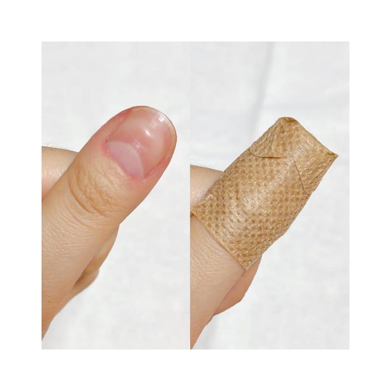 Kerasel Nighttime Patch (14 sheets, 2 packs) / Nail nutrient and nail strengthener