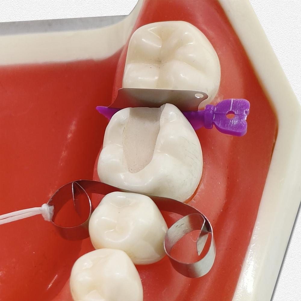 Dental Matrix Wedge Guards Sectional Baffle Type Matrice Teeth Interproximal Wedge Knife With Protection Steel Matrix Dentistry
