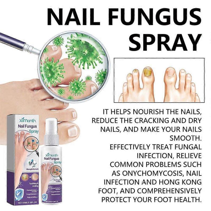 2025 Latest Model Nail Fungus Spray, Foot Moss Relief Deodorizing Odor Removal new