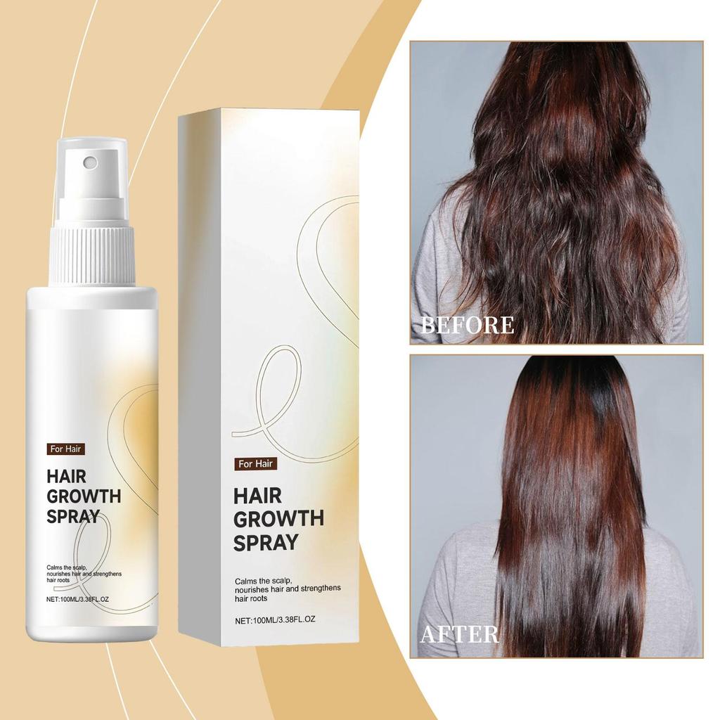 Haarwachstumsspray Beruhigt die Kopfhaut Fördert die Haargesundheit Stärkt die Haarwurzeln Spendet tiefen Feuchtigkeit Ölregulierende Formel