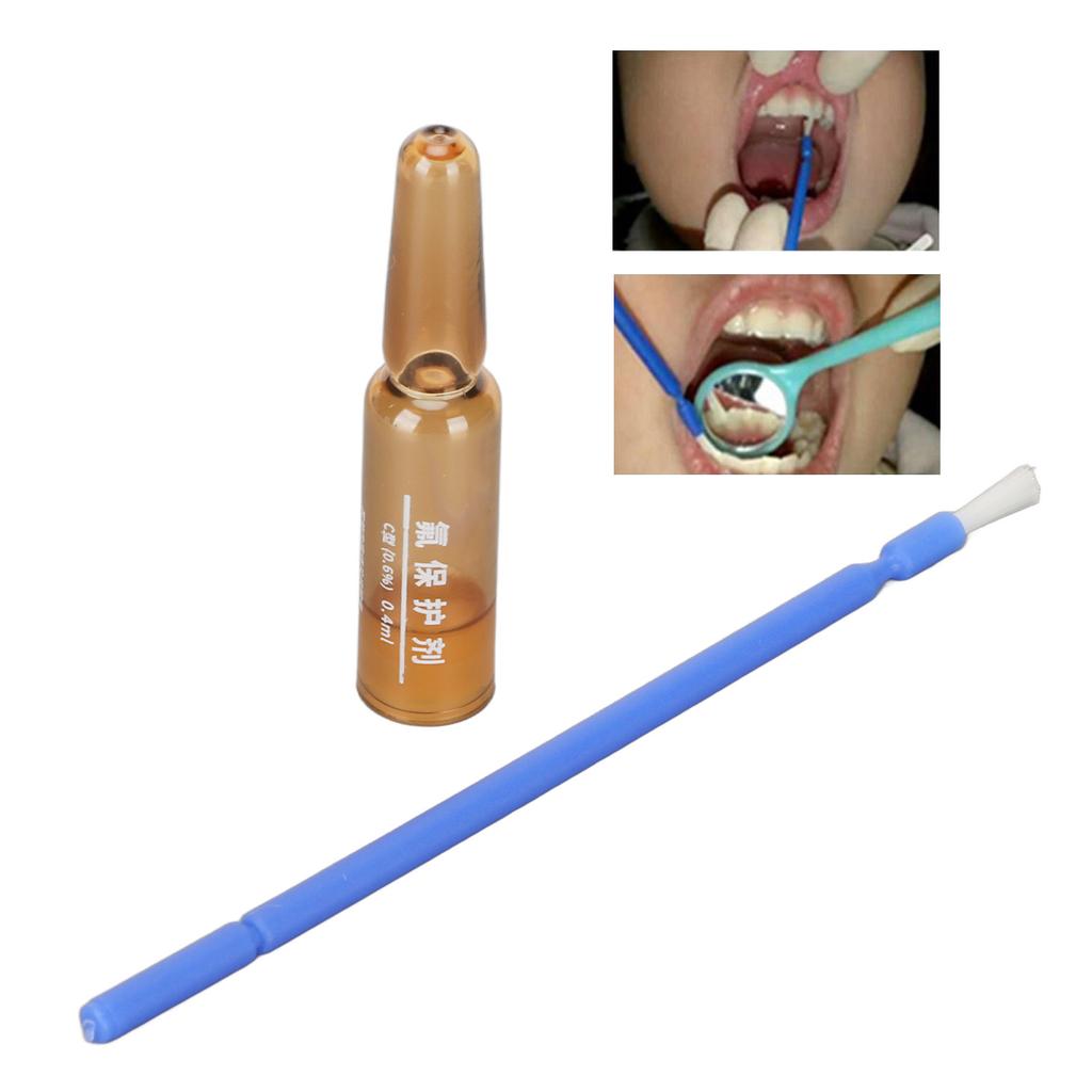 0,4 ml Natriumfluorid-Lack Dentalanwendung Typ C Schutzmittel für empfindliche Zähne Karieslöcher verhindern
