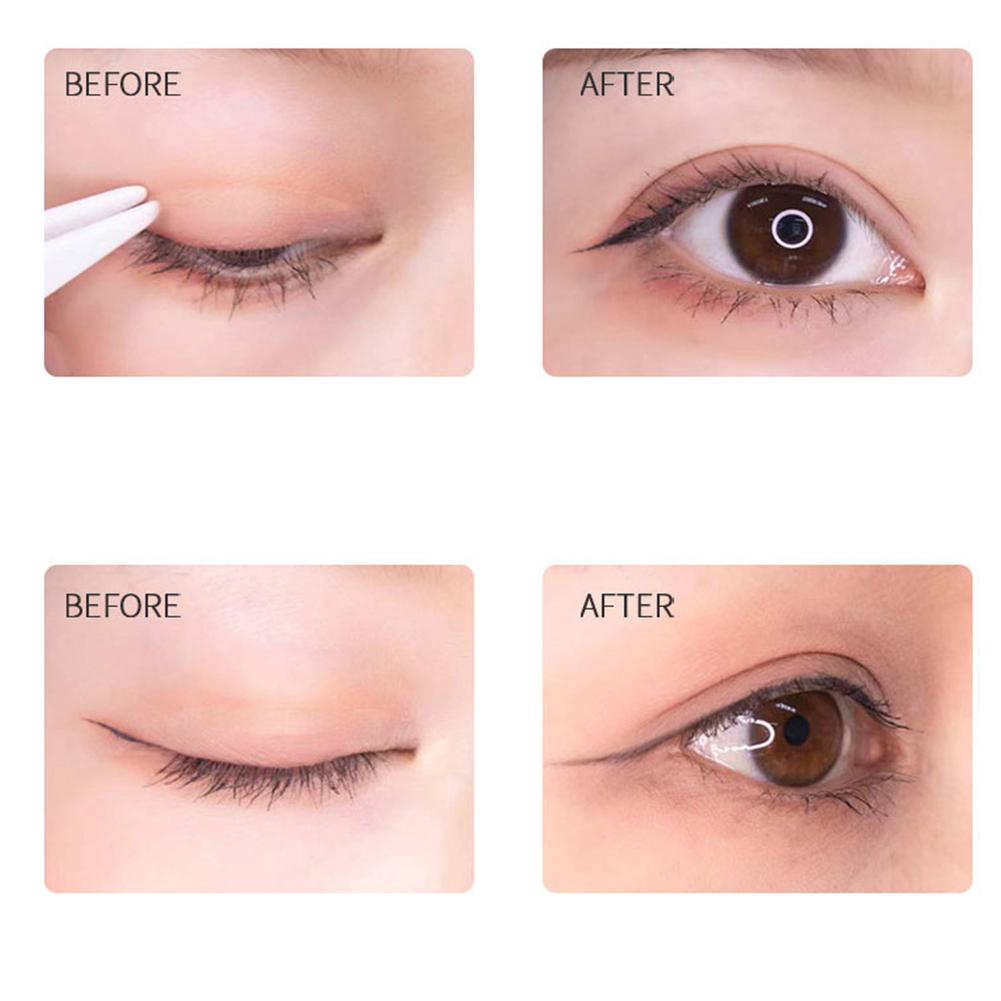 10 Pieces Double Eyelid Patch Lying Silkworm Transparent Patch Eye And Swollen Blisters Tracele I4N7