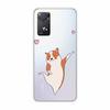 For Xiaomi Redmi Note 11 Pro 5G Case Transparent Soft TPU silicon Phone Cover For Xiaomi Redmi Note11 Pro 4G Case Clear Funda