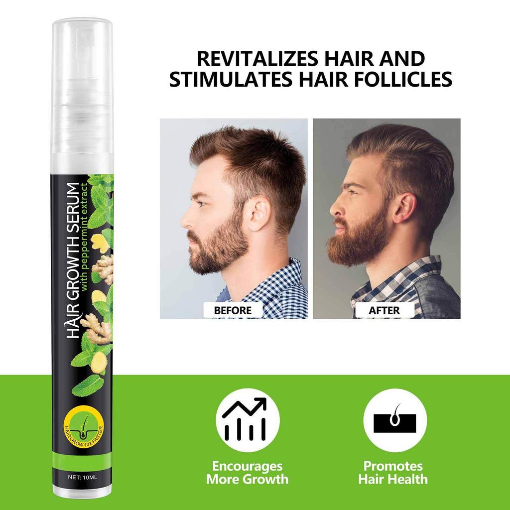 Minz-Zahnpasta-Öl, Haarserum-Pflege, verhindert Haarbruch, Haarwachstum, verhindert Haarausfall, Haarpflege, nährendes Kopfhautspray, 10 ml
