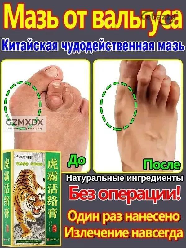 hip ointment 50 g