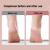 Pedicure Elettrico Automatico Domestico Doppia Velocità Rimuovi Calli Staccabile Lavabile Esfoliante