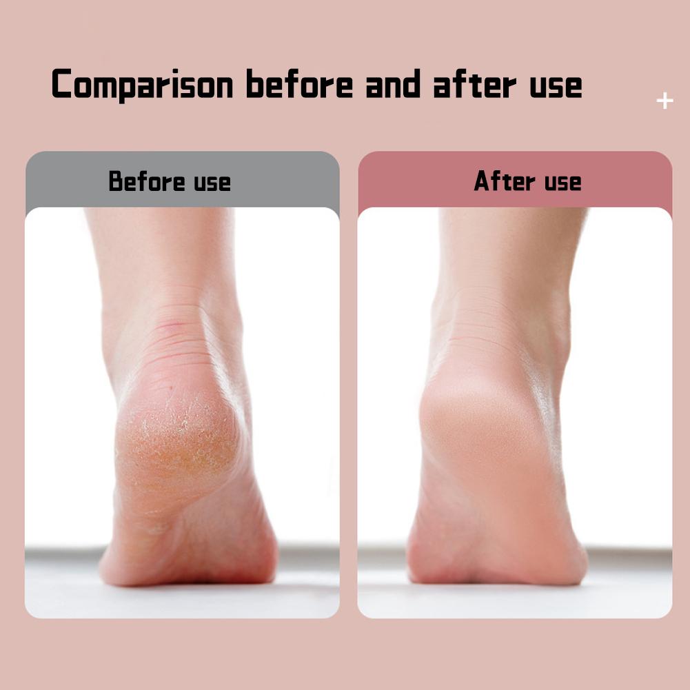 Pedicure Elettrico Automatico Domestico Doppia Velocità Rimuovi Calli Staccabile Lavabile Esfoliante