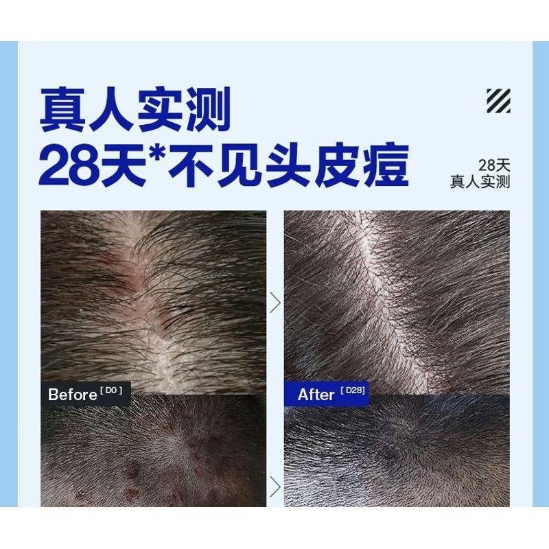 Z:SEA - Water Oil-Control & Anti-Acne Shampoo