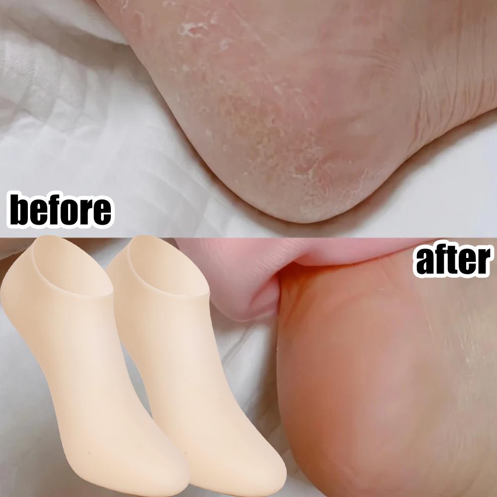 Silicone Gel Moisturizing Socks Skin-Friendly Foot Care for Dry Cracked Feet