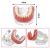 Dental Teeth Model With Implants Gold/Silver Bar Type Overdenture Restoration Treatment Typodont For Dentist Patient Teaching
