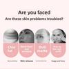 EMS Roller Face-Slimming Artifact V-Face Beauty Facial Massager For Firming And Lifting The Face