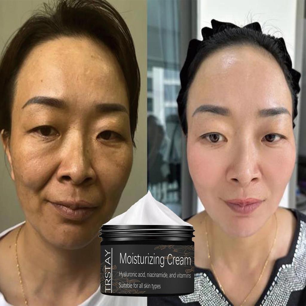 Moisturizing Hyaluronic Acid Nourishing Moisturizing Cream, Gentle and Non-irritating, Hydrating and Moisturizing, Nourishing the Skin