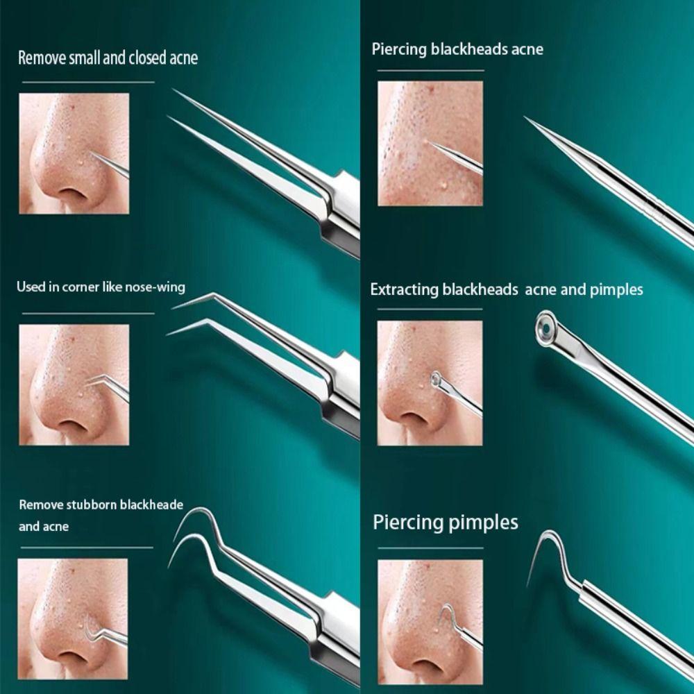 Deep Cleaner Facial Care Beauty Salon Blackhead Tweezers Cell Clip Acne Needle Pimple Remover