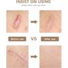 1 Roll Silicone Gel Scar Sheet Patch Treatment Removal Tape Cover Burn Trauma Repair Acne Ear Scar Section Beauty Skin