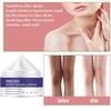 Body Whitening Cream Underarm Knee Buttocks Private Bleach Remove Melanin Pigmentation Improve Dull Nourish Brighten Skin Care