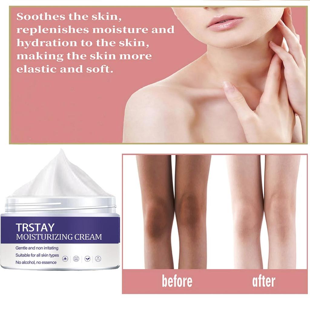 Body Whitening Cream Underarm Knee Buttocks Private Bleach Remove Melanin Pigmentation Improve Dull Nourish Brighten Skin Care