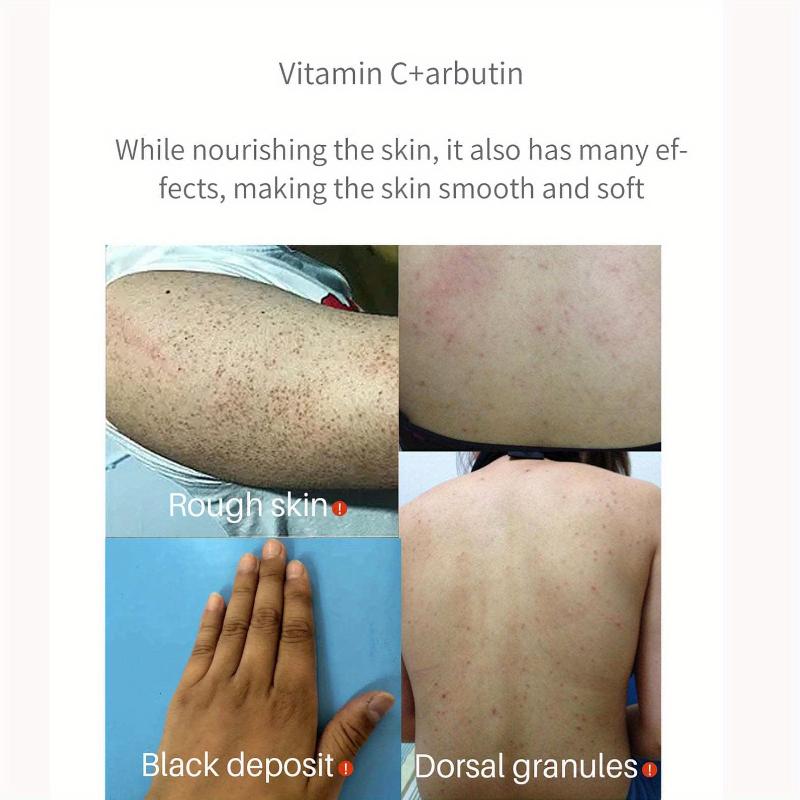 100 ml Körperaufhellungscreme Kurkuma-Körperlotion Langanhaltende feuchtigkeitsspendende, glatte Hautaufhellungscreme für dunkle Haut