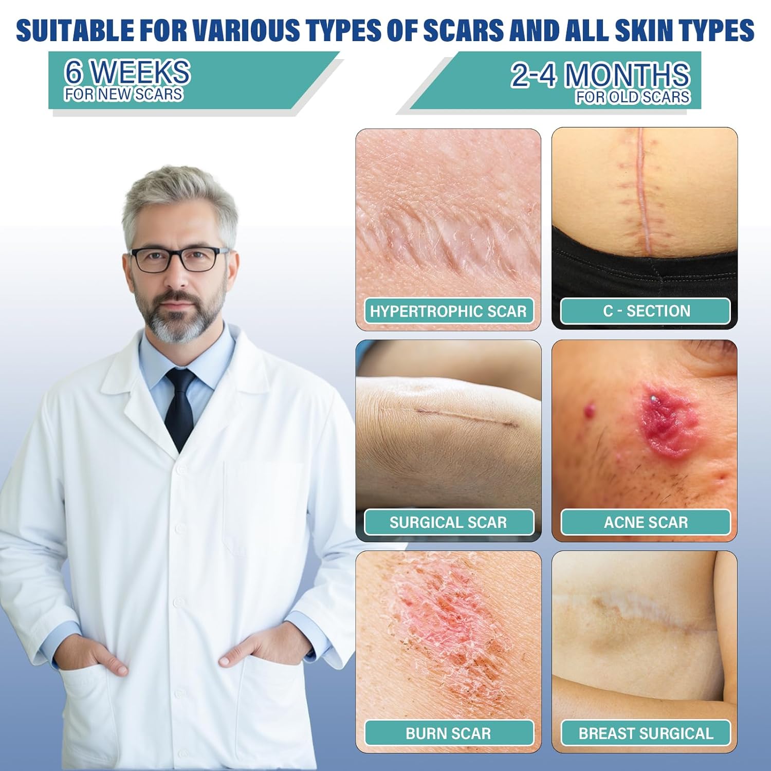 Silicone Scar Sheets,Silicone Scar Tape(1.6 x 158  Roll-4 meters),Silicone Scar Sheets for Surgical Scars,Keloid Bump Removal,Scar Tape for