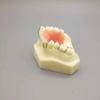 Maxillary Partial Denture Demonstration Model - White Tooth for Doctor-Patient Communication (Free Shipping)