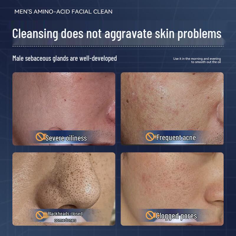 

Qingyan Men s Oil Control & Acne Facial Cleanser