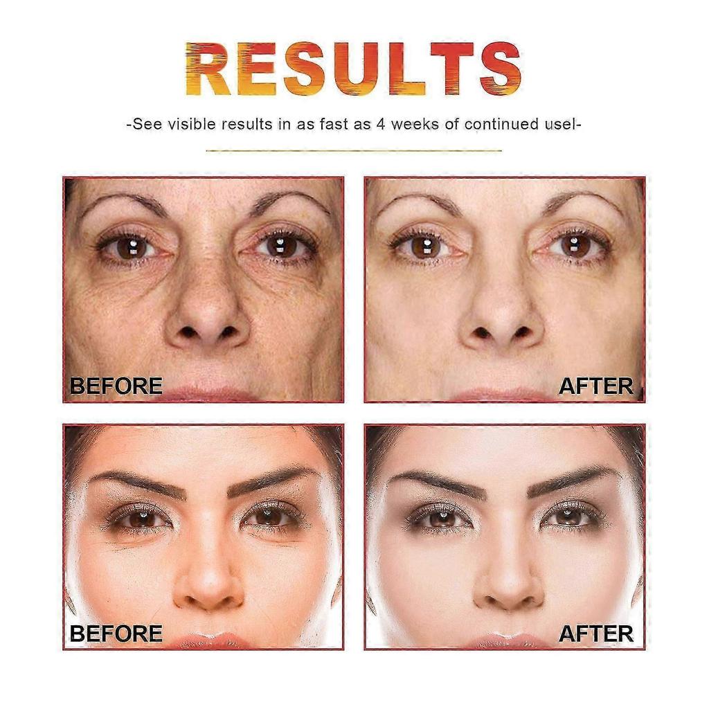Vitamin C Anti-Aging Serum for Brightening & Hydration - Reduces Fine Lines, Wrinkles, Spots | Boost Skin Elasticity & Youthful Glow | Suitable for Al
