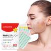 200pcs Star Acne Patches - Cleanses Pores, Removes Dead Skin, Fades Acne Scars, and Conceals Acne.