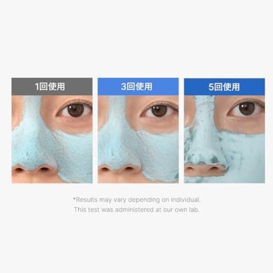 Medikube Zero Pore Clay Pack Oily Skin Face