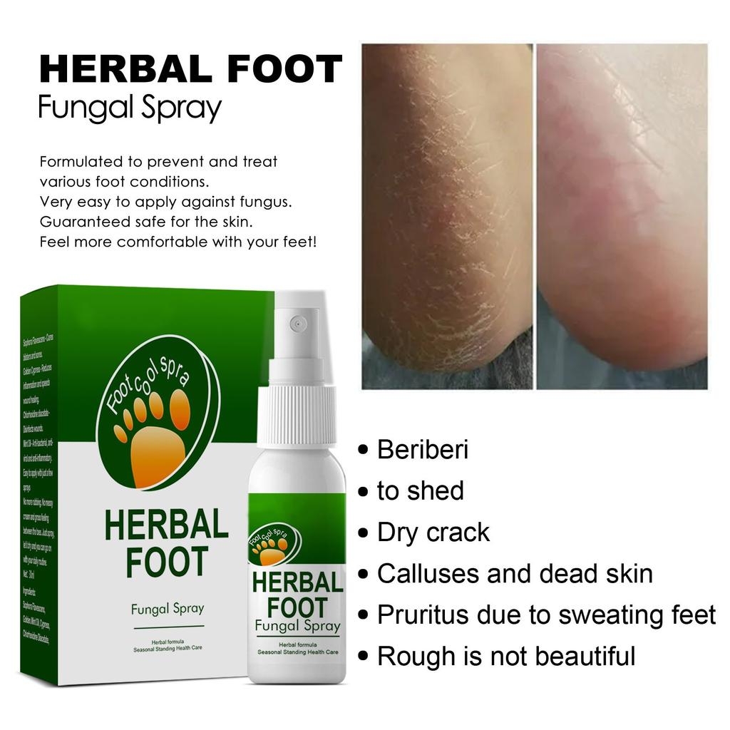 30ml Herbal Foot Spray Foot Sweat Foot Odor Itching Relieving Spray Odor Peeling Foot Care Spray