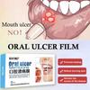 Szybka Pielęgnacja Plaster na Owrzodzenia Jamy Ustnej Opatrunek na Rany Jamy Ustnej Do Aft Szybka Ulga w Bólu Lek na Afty Środek Przeciwbólowy