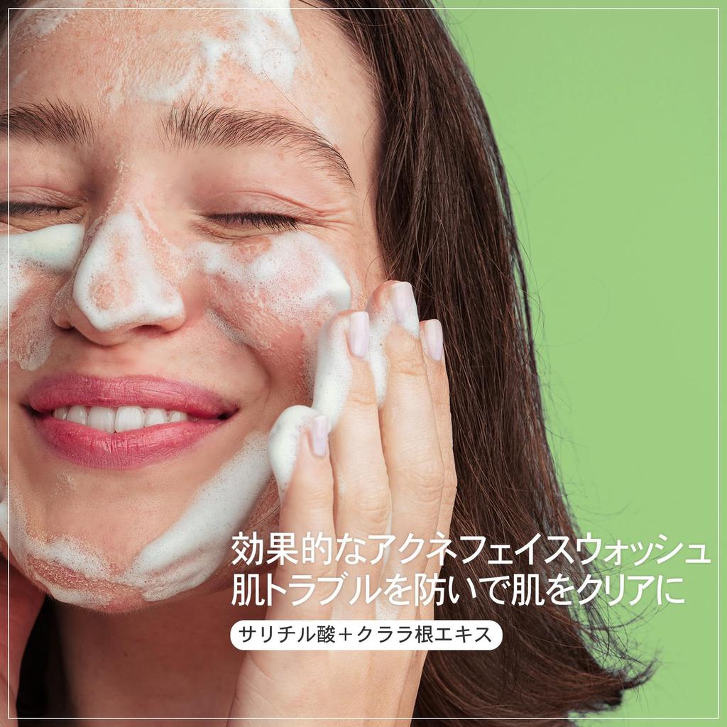 NATUREKIND Acne Deep Cleansing Facial Makeup Pore Sebum Blackhead Rough Acne Korean Skincare Cosmetics Foam, 100ml, Cleanser, Remover, Cleanser,